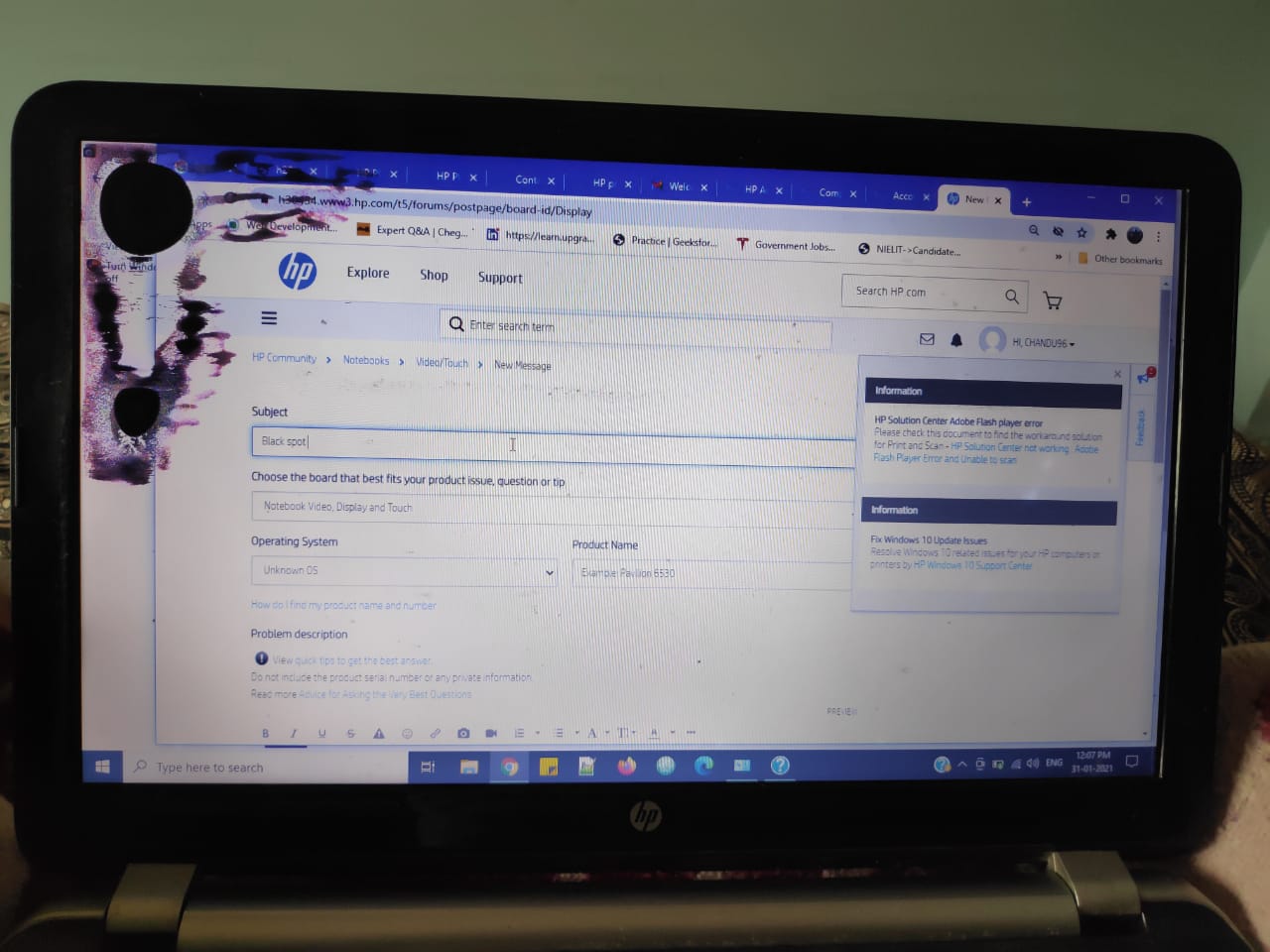 dark spots on laptop screen